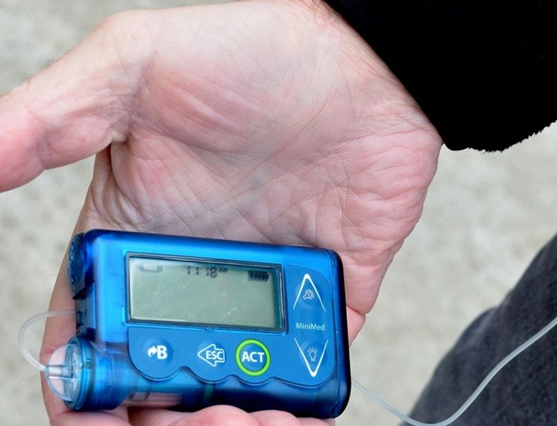 inzulinov&aacute; pumpa